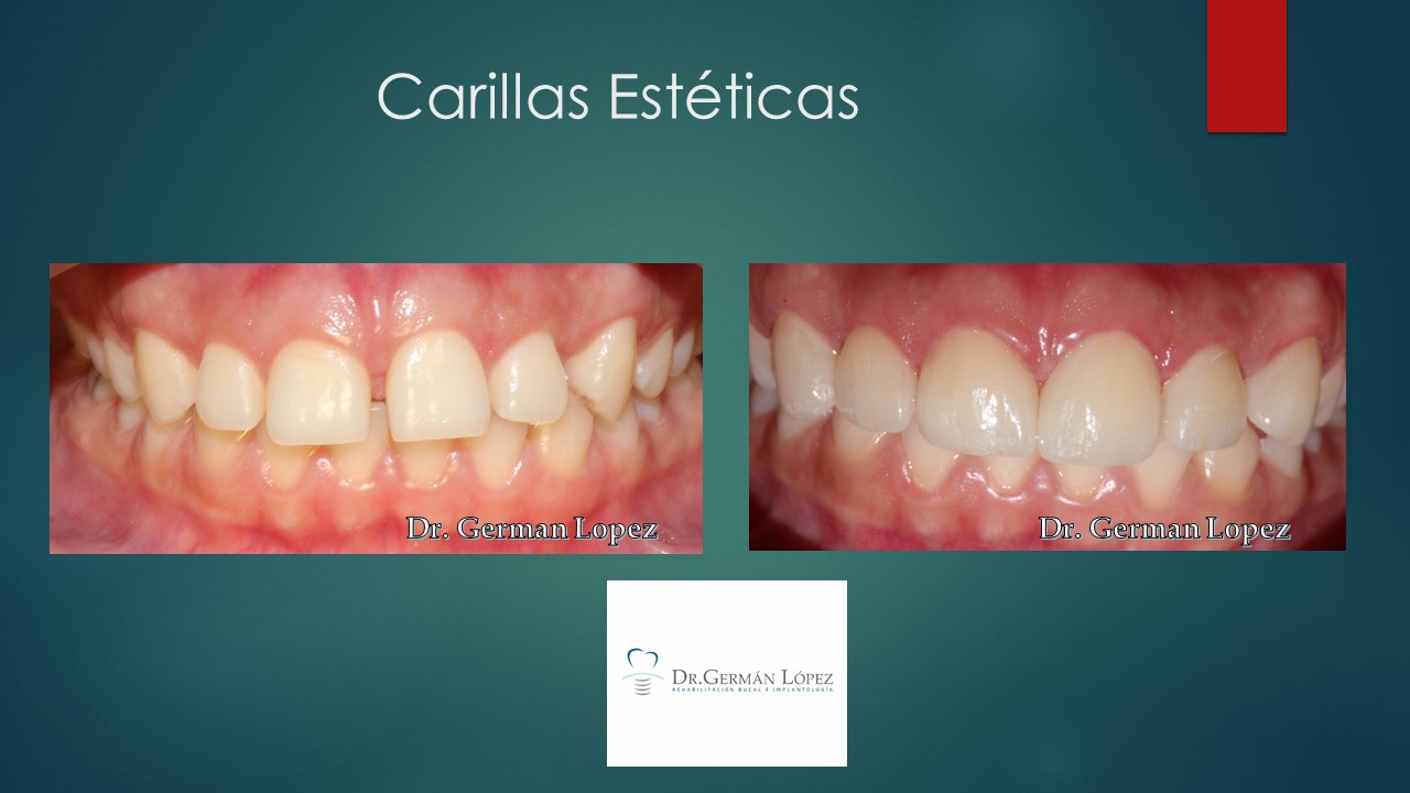 Germán López Álvarez